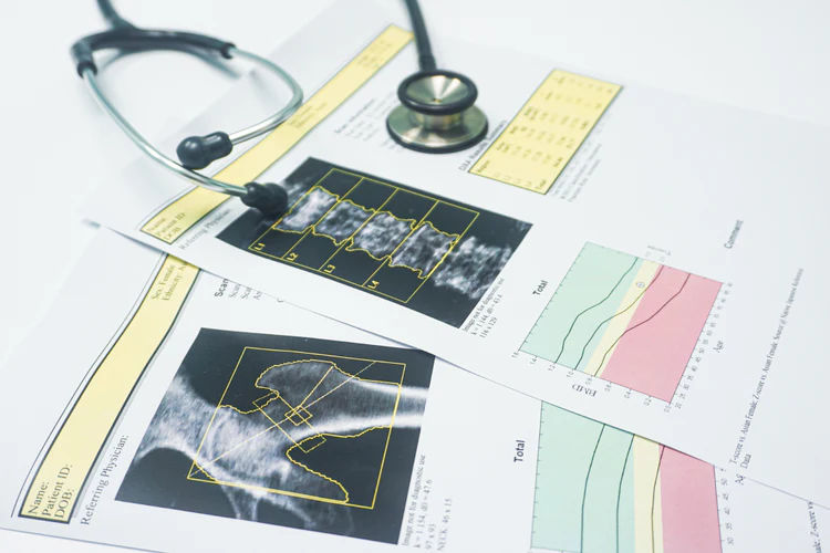 DEXA scan